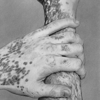 Zeichnungen mit dem Titel "Vitiligo" von Marion Roy, Original-Kunstwerk, Bleistift