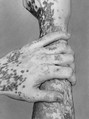 Desenho intitulada "Vitiligo" por Marion Roy, Obras de arte originais, Lápis